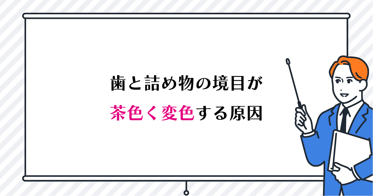 【新潟で詰め物治療】歯と詰め物の境目が茶色く変色する原因