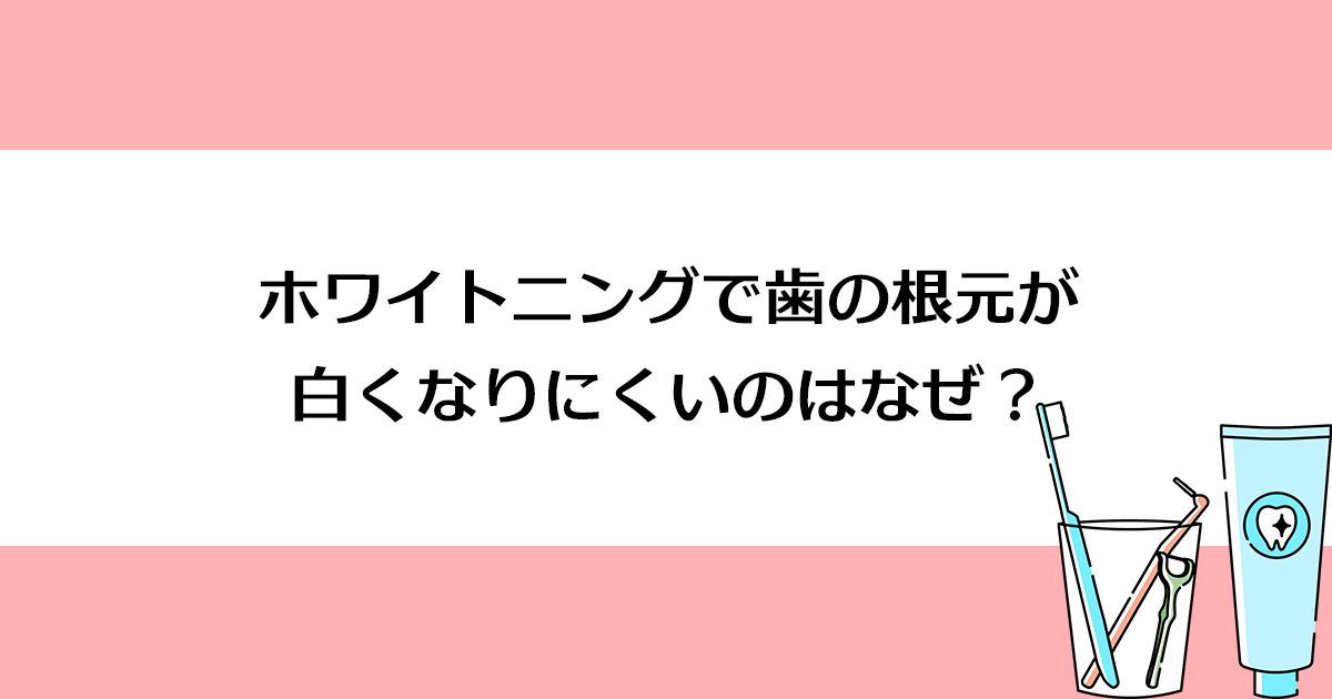 【新潟の歯医者でホワイトニング】ホワイトニングで歯の根元が白くなりにくいのはなぜ?